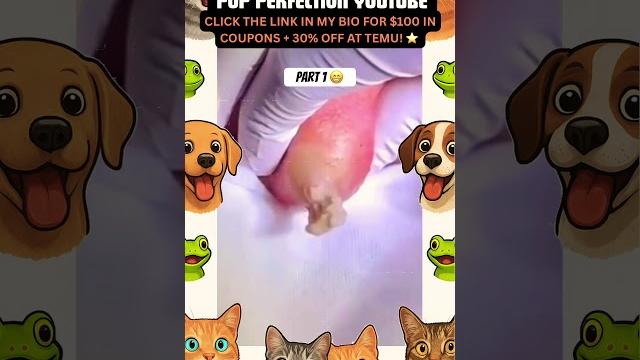 Wow! #pimple #pimplepopping #pimples #shortsfeed #shortvideo #shorts #short #youtubeshorts #youtube Wow! #pimple #pimplepopping #pimples #shortsfeed #shortvideo #shorts #short #youtubeshorts #youtube