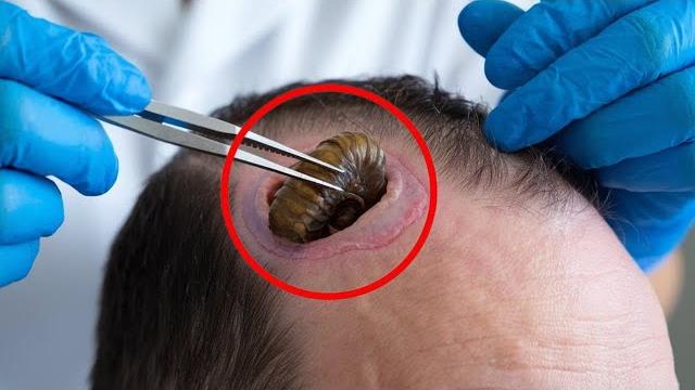 Самые жуткие насекомые в мире Самые жуткие насекомые в мире