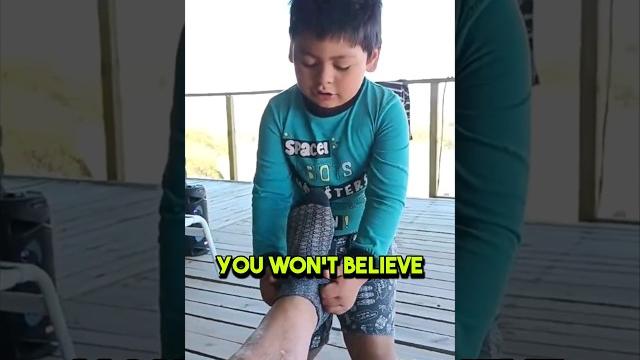 He took off his socks but then this happened! He took off his socks but then this happened!