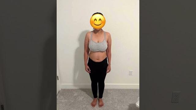 Postpartum belly button from outie to innie!! Postpartum belly button from outie to innie!!