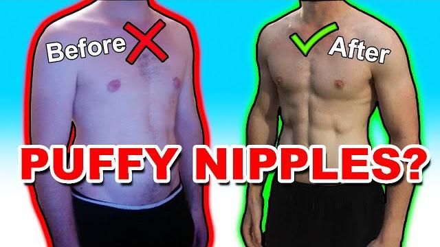 How i got rid of my puffy nipples without surgery! How i got rid of my puffy nipples without surgery!