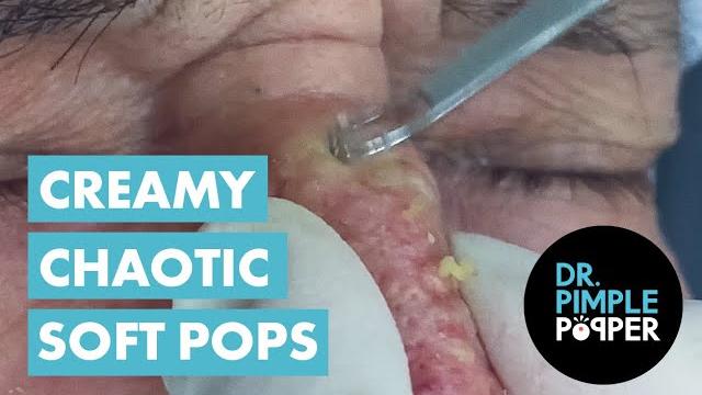 Creamy soft pops that altered my brain chemistry Creamy soft pops that altered my brain chemistry