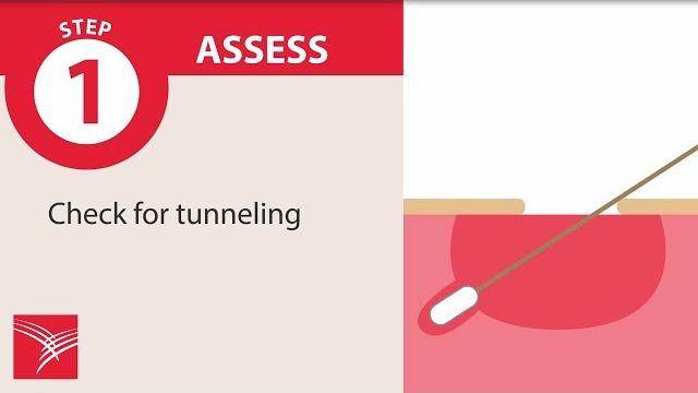 7 steps to effective wound care management 7 steps to effective wound care management