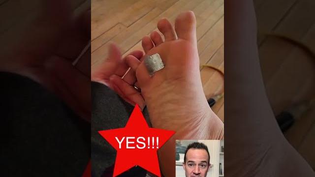Doctor reacts - plantar warts & duct tape! #shorts #reaction Doctor reacts - plantar warts & duct tape! #shorts #reaction