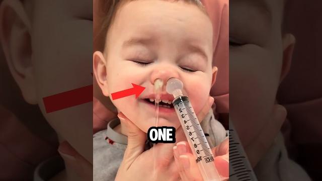 This came out of the baby’s nose! This came out of the baby’s nose!