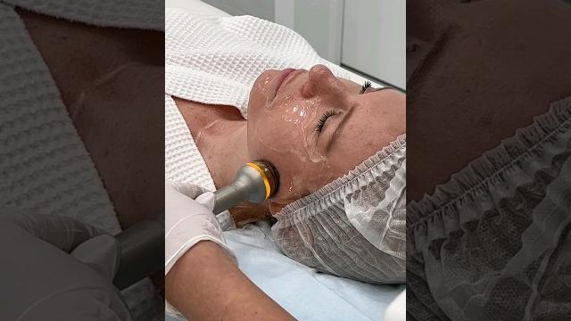Ультразвуковая подтяжка лица skinova pro - омоложение кожи без операции | клиника gen87 #shorts Ультразвуковая подтяжка лица skinova pro - омоложение кожи без операции | клиника gen87 #shorts