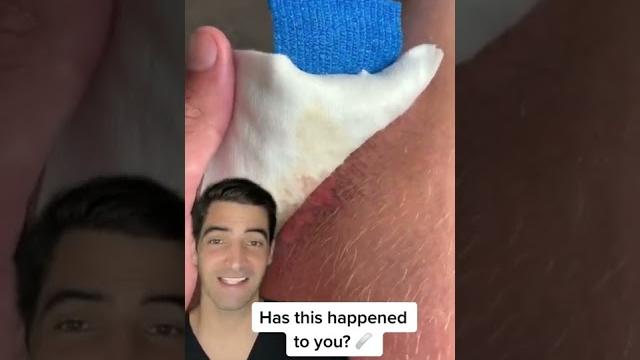 Non adhesive bandage Non adhesive bandage