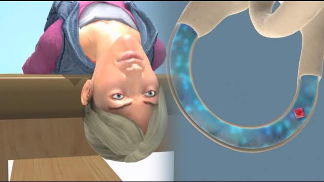 Deep head hanging maneuver to treat bppv vertigo Deep head hanging maneuver to treat bppv vertigo