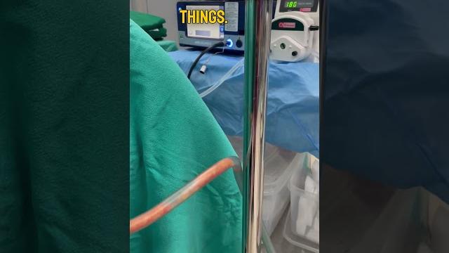 Defining muscles with two-layer tummy liposuction : surgical video | liposuction surgery in india Defining muscles with two-layer tummy liposuction : surgical video | liposuction surgery in india