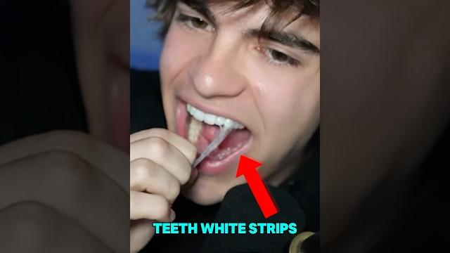 Do teeth whitening strips actually work ⁉️ Do teeth whitening strips actually work ⁉️