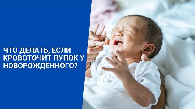 Что делать, если кровоточит пупок у новорожденного? Что делать, если кровоточит пупок у новорожденного?