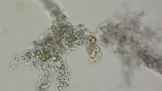 Amoeba reproduction: cell division Amoeba reproduction: cell division