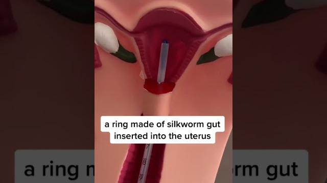 Iud Iud