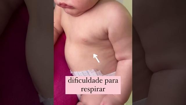 Bronquiolite ela está voltando | alerta para dificuldade de respiração nos bebês | #maternidade Bronquiolite ela está voltando | alerta para dificuldade de respiração nos bebês | #maternidade