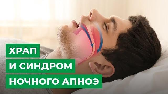 Храп и синдром ночного апноэ Храп и синдром ночного апноэ