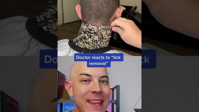 Crazy tick removal? or fake? Crazy tick removal? or fake?