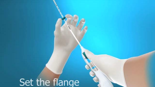 Animation for insertion of mirena iud Animation for insertion of mirena iud