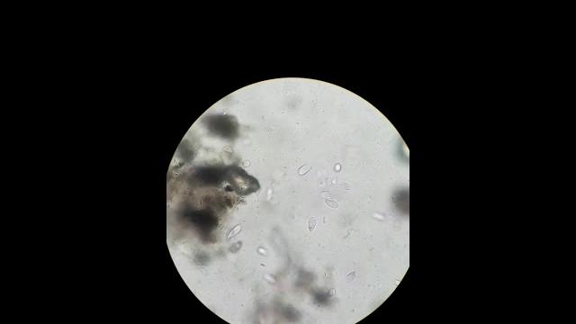 Balantidium coli Balantidium coli