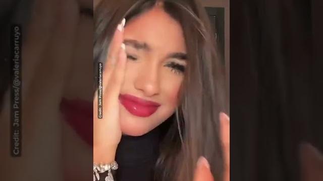 Tiktok star viciously attacked and nearly blinded by her own cat – leaves viewers terrified Tiktok star viciously attacked and nearly blinded by her own cat – leaves viewers terrified