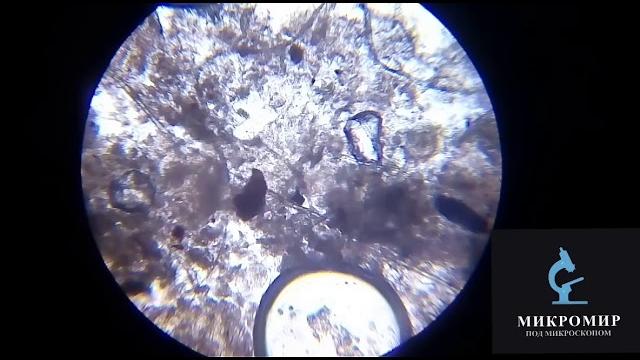 Грязь под ногтями под микроскопом Грязь под ногтями под микроскопом