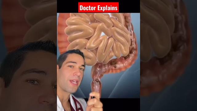 Problems with an enema? #doctor #shorts Problems with an enema? #doctor #shorts