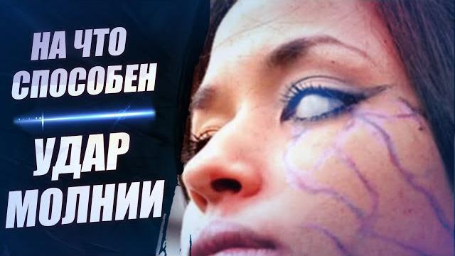 Удар молнии в человека, дом, машину, воду, дерево, следы на теле, как избежать? последствия грозы 21 Удар молнии в человека, дом, машину, воду, дерево, следы на теле, как избежать? последствия грозы 21