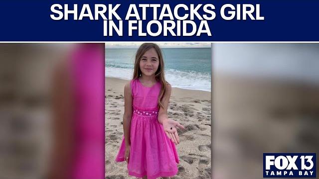 Boca grande shark attack severely injures child Boca grande shark attack severely injures child