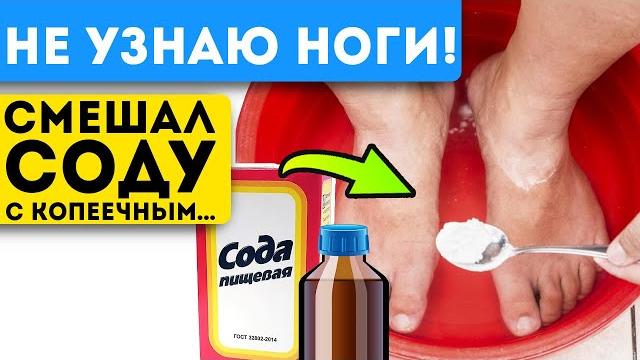 Результат мгновенный! грибок и мозоли отвалились, стоило лишь окунуть ноги в раствор соды с … Результат мгновенный! грибок и мозоли отвалились, стоило лишь окунуть ноги в раствор соды с …