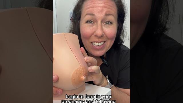 Little bumps around the nipple…what are they? #mom #breastfeeding #lactation #pregnancy #pregnant Little bumps around the nipple…what are they? #mom #breastfeeding #lactation #pregnancy #pregnant
