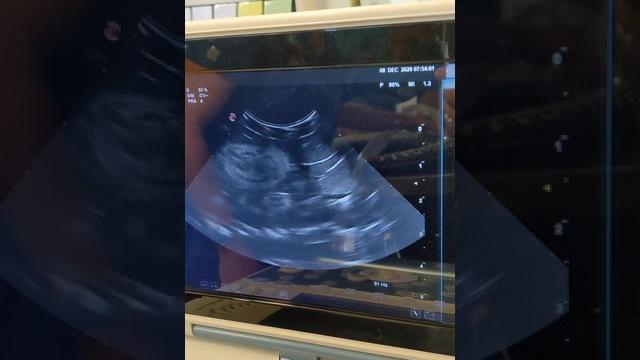 Snake ultrasound Snake ultrasound