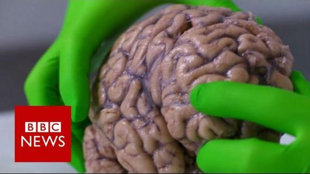 Up close with a human brain - bbc news Up close with a human brain - bbc news