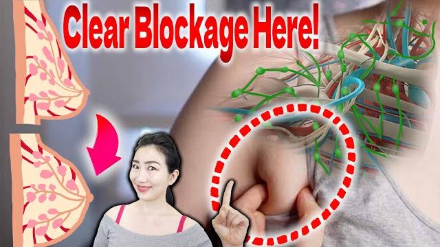 Removing chest lymphatic blockage massage drastically lifts sagging breasts & prevent breast cancer Removing chest lymphatic blockage massage drastically lifts sagging breasts & prevent breast cancer