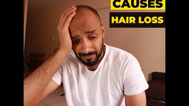 Hair loss due to masturbation? #shorts Hair loss due to masturbation? #shorts