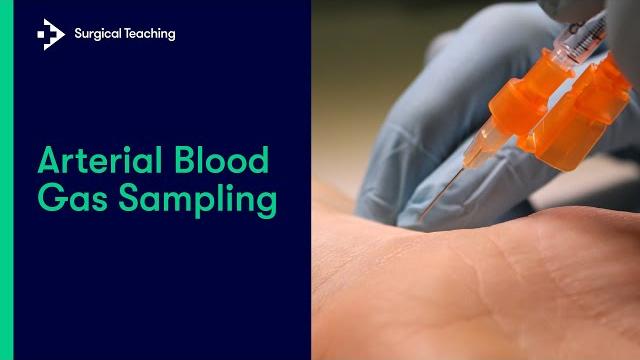 Arterial blood gas (abg) sampling | everything you need to know to perform this vital procedure Arterial blood gas (abg) sampling | everything you need to know to perform this vital procedure