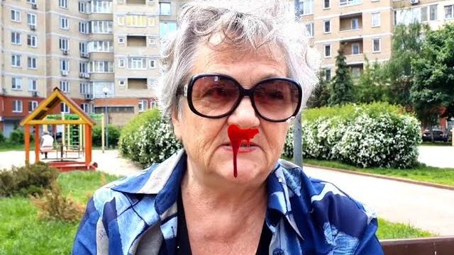 Постоянно идет кровь с носа! что делать? куда идти? Постоянно идет кровь с носа! что делать? куда идти?