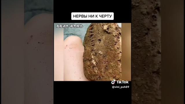 Нервы ни к черту 2 #shorts Нервы ни к черту 2 #shorts