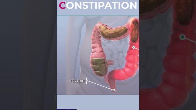 Constipation #shorts Constipation #shorts
