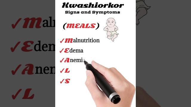 Kwashiorkor symptoms Kwashiorkor symptoms