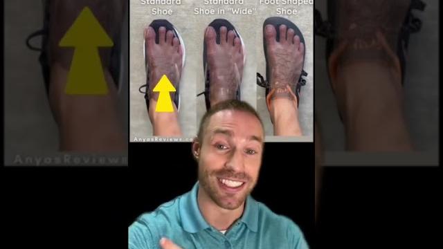The problem with “wide” shoes The problem with “wide” shoes