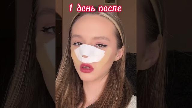 Я решила сделать пластическую операцию Я решила сделать пластическую операцию