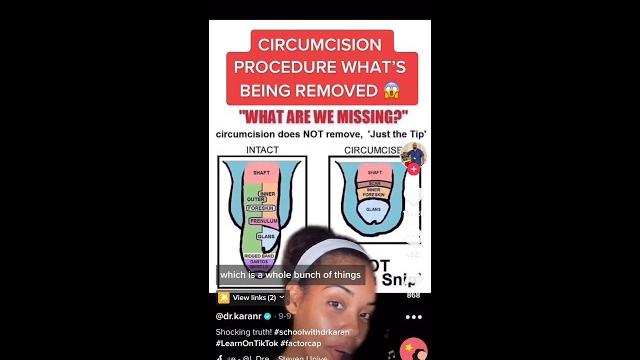 Circumcision procedure: what's being removed? #shorts Circumcision procedure: what's being removed? #shorts