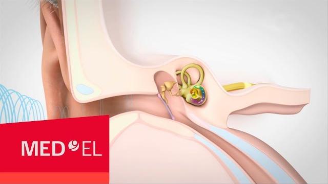 Vidéo sur l’audition et son fonctionnement | med-el Vidéo sur l’audition et son fonctionnement | med-el