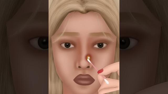 Asmr - 여드름 피부 관리 애니메이션 - nose treatment skin care - spa facial makeup #asmr #shorts #nosetreatment Asmr - 여드름 피부 관리 애니메이션 - nose treatment skin care - spa facial makeup #asmr #shorts #nosetreatment