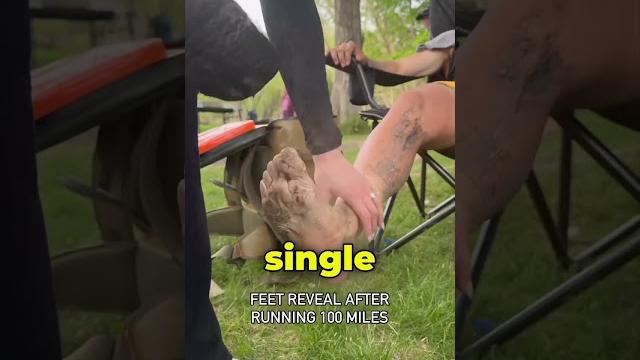 Feet after a 100 mile marathon (@brockcovington) Feet after a 100 mile marathon (@brockcovington)