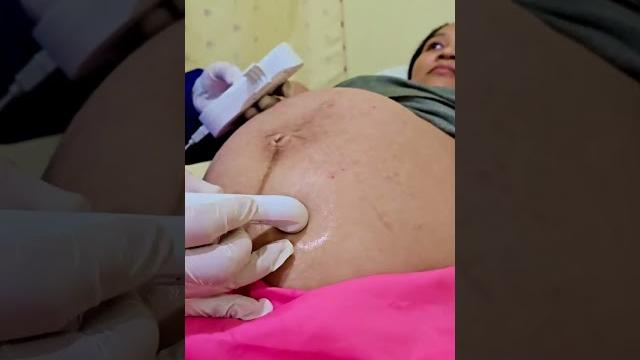 A #birthbaby pulse examination during #pregnancy on #philippines #birth #labor #hamil #bumil A #birthbaby pulse examination during #pregnancy on #philippines #birth #labor #hamil #bumil