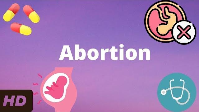 Abortion: everything you need to know Abortion: everything you need to know