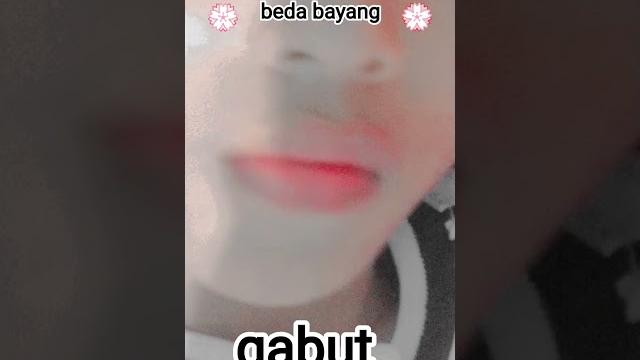Gigi##gingsul Gigi##gingsul
