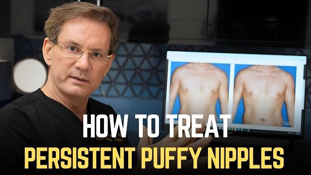 How to treat persistent puffy nipples How to treat persistent puffy nipples