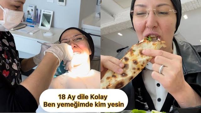 Di̇ş teli̇ nasil sökülmeli̇ şok yaşadim️hi̇ç antep lahmacunu yedi̇ni̇zmi̇? yerken çok şaşirdim Di̇ş teli̇ nasil sökülmeli̇ şok yaşadim️hi̇ç antep lahmacunu yedi̇ni̇zmi̇? yerken çok şaşirdim