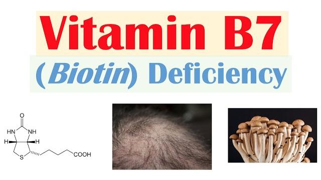 Vitamin b7 biotin deficiency | sources, purposes, causes, symptoms, diagnosis, treatment Vitamin b7 biotin deficiency | sources, purposes, causes, symptoms, diagnosis, treatment